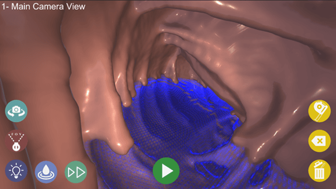 Colonoscopia Virtual